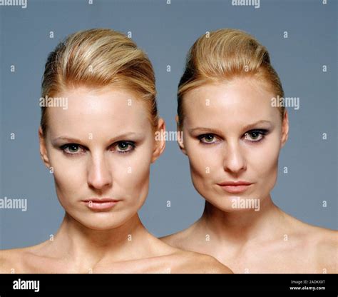 atogm|identical twins atogm back and forth .